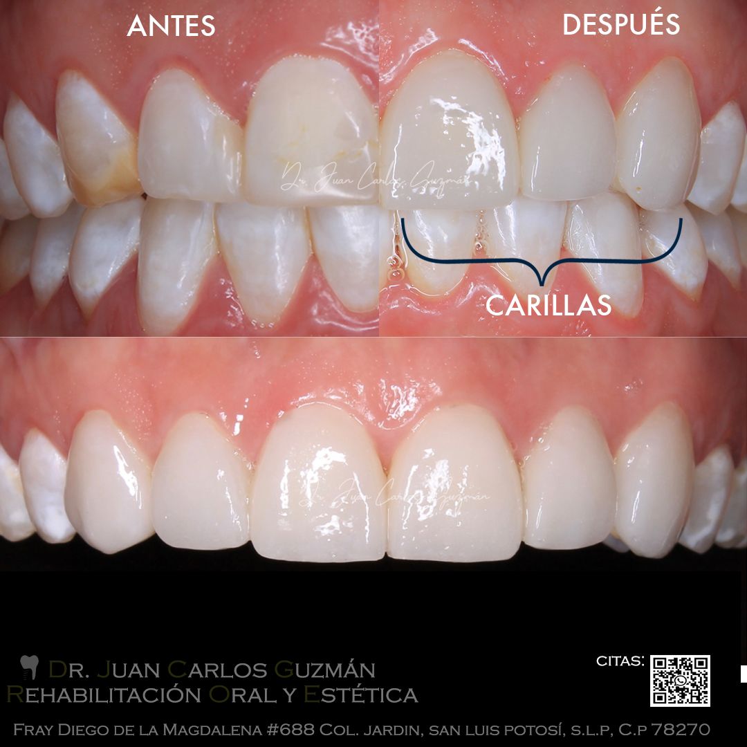 Juan Carlos Guzmán Castañeda-22