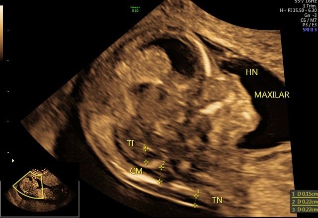 Andrés Rosero Flores-0