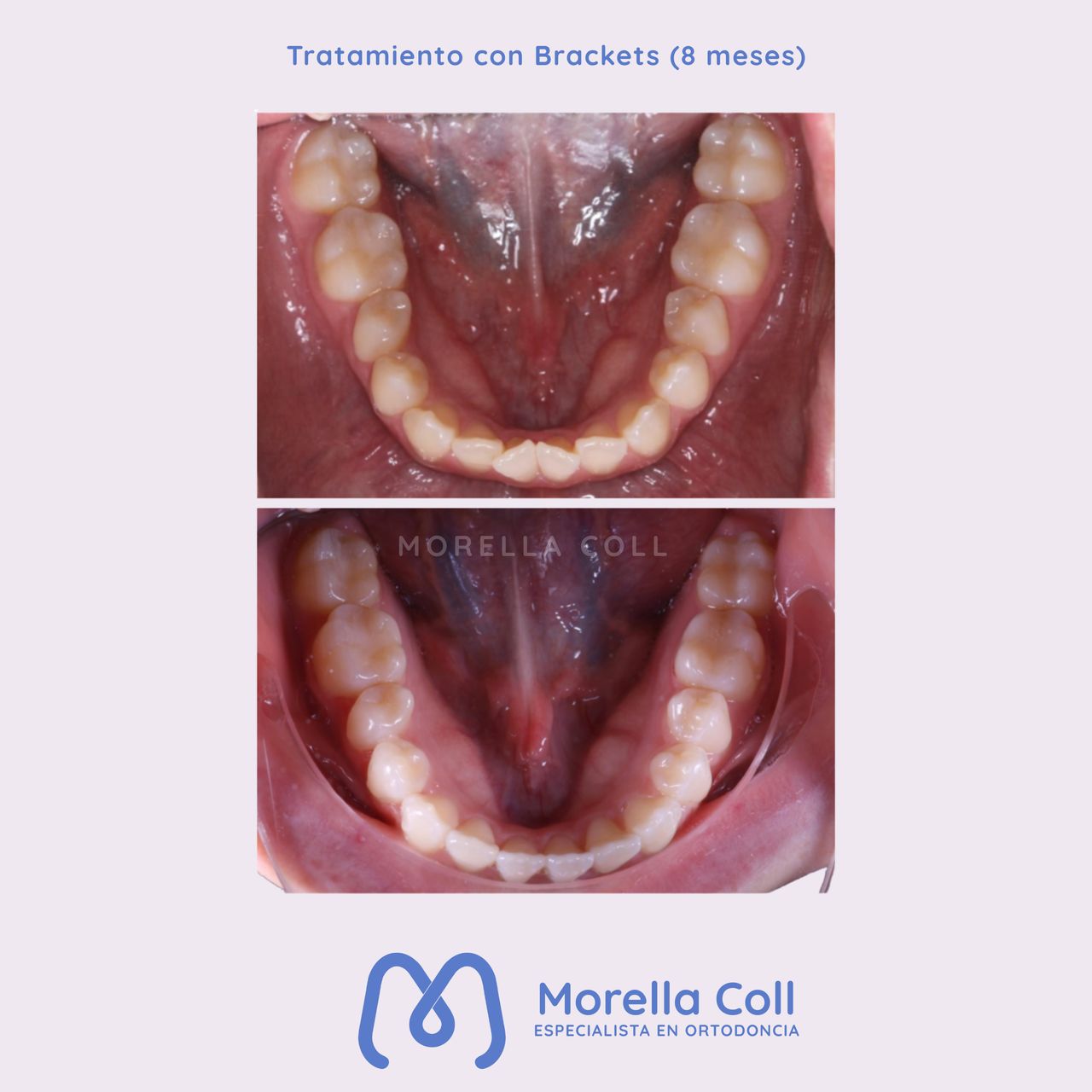 Morella Coll Mibelli-16