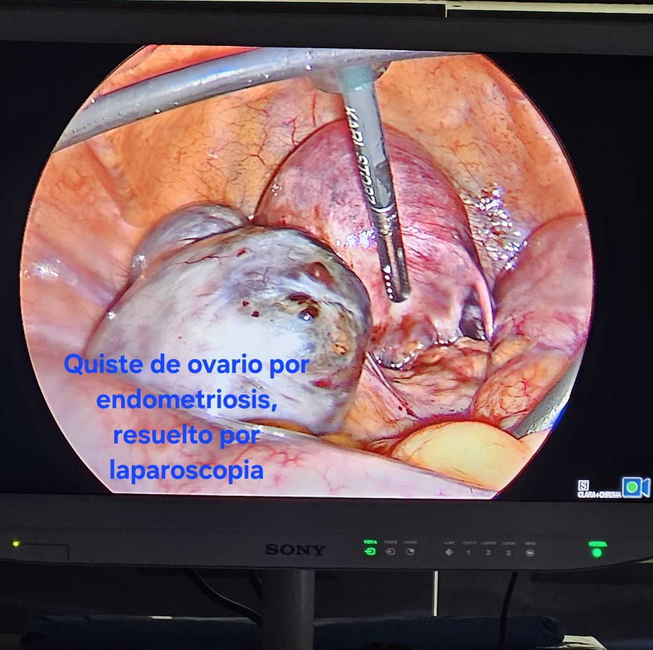 Jorge Alberto Rodriguez Pezino-33