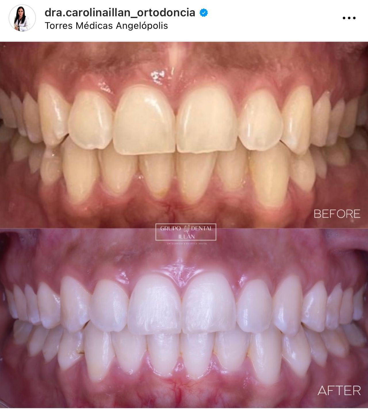 Diana Carolina Illán Gallardo-20