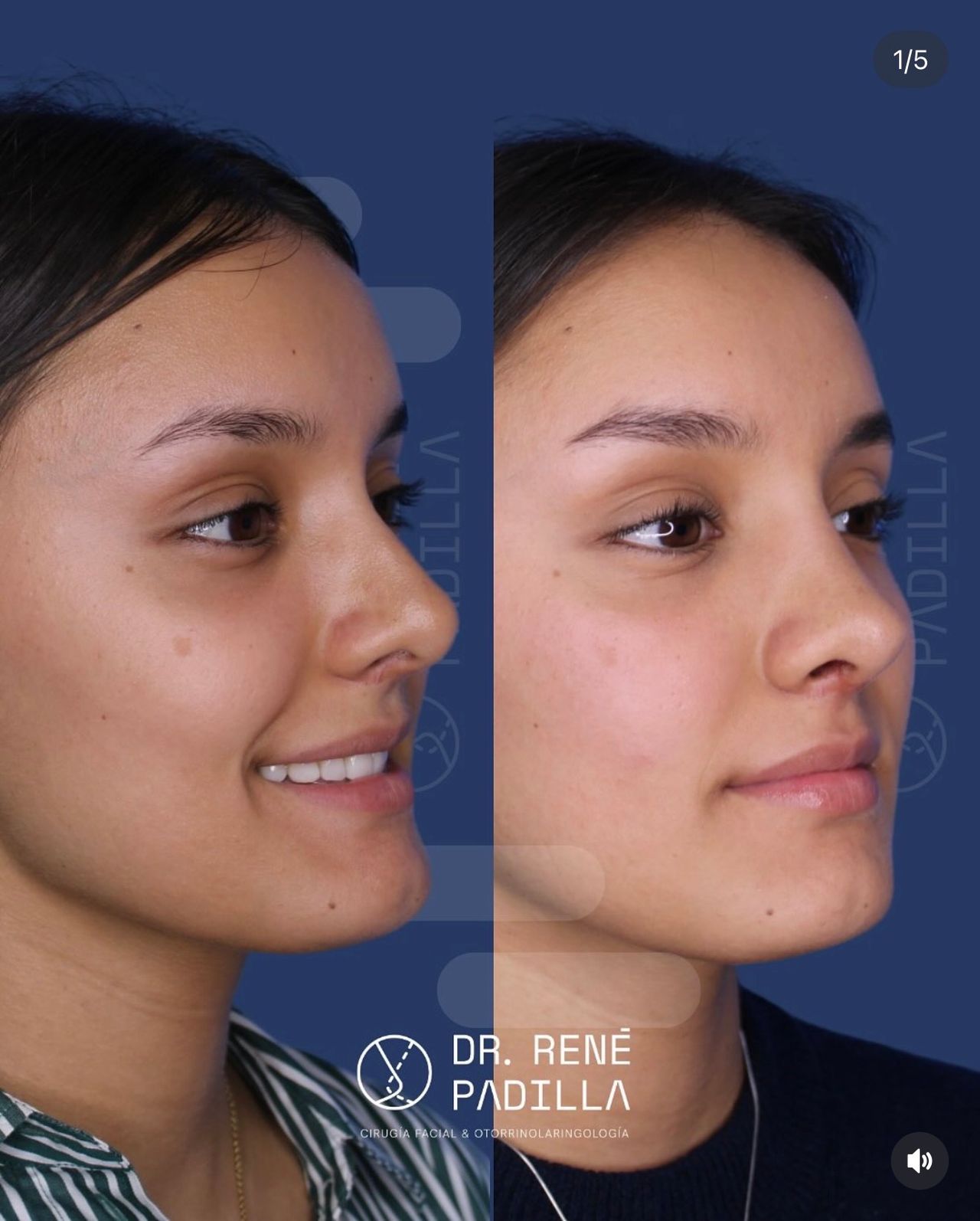 René Emmanuel Padilla López-20