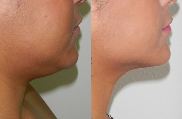 Edgar Ernesto Torres Mejía-10