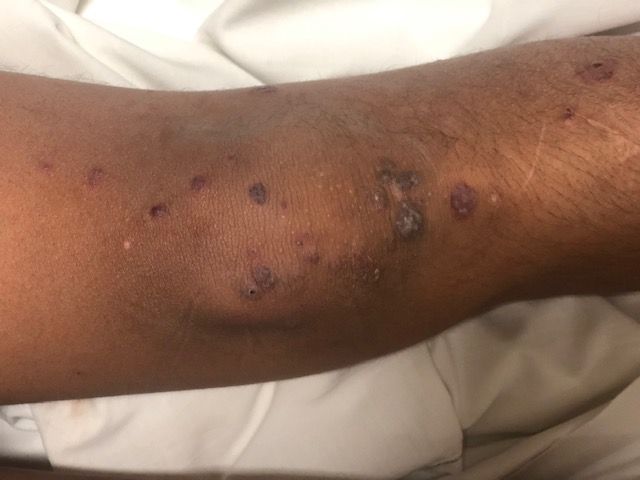 Joel Barroso Santos-52