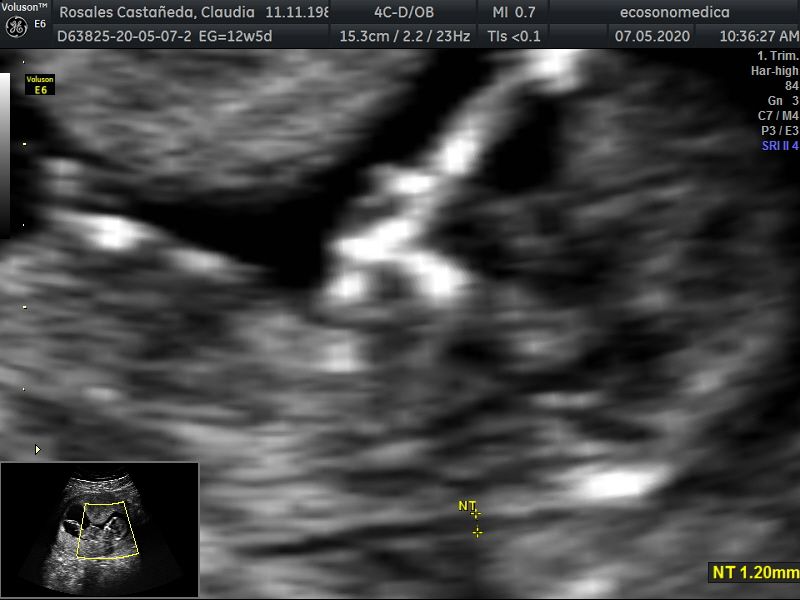 Héctor Bernardo Acevedo Manrique-16