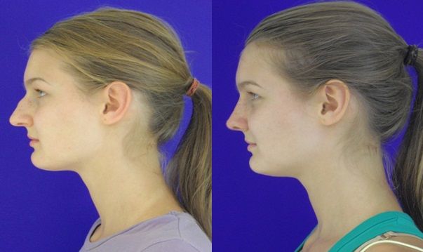 Carlos Gerardo Alfaro Moreno-25