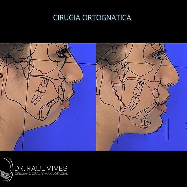 Raúl José Vives Serrano-15