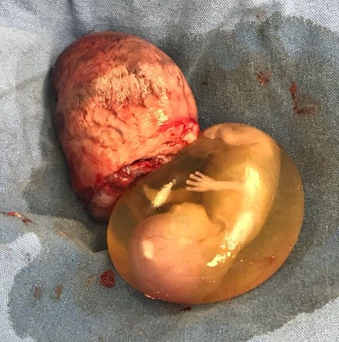 Hilda Rguez Zubieta-0