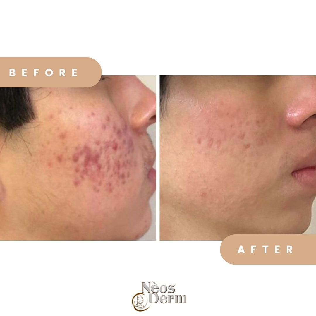 Ingrid Gómez Yepes-13