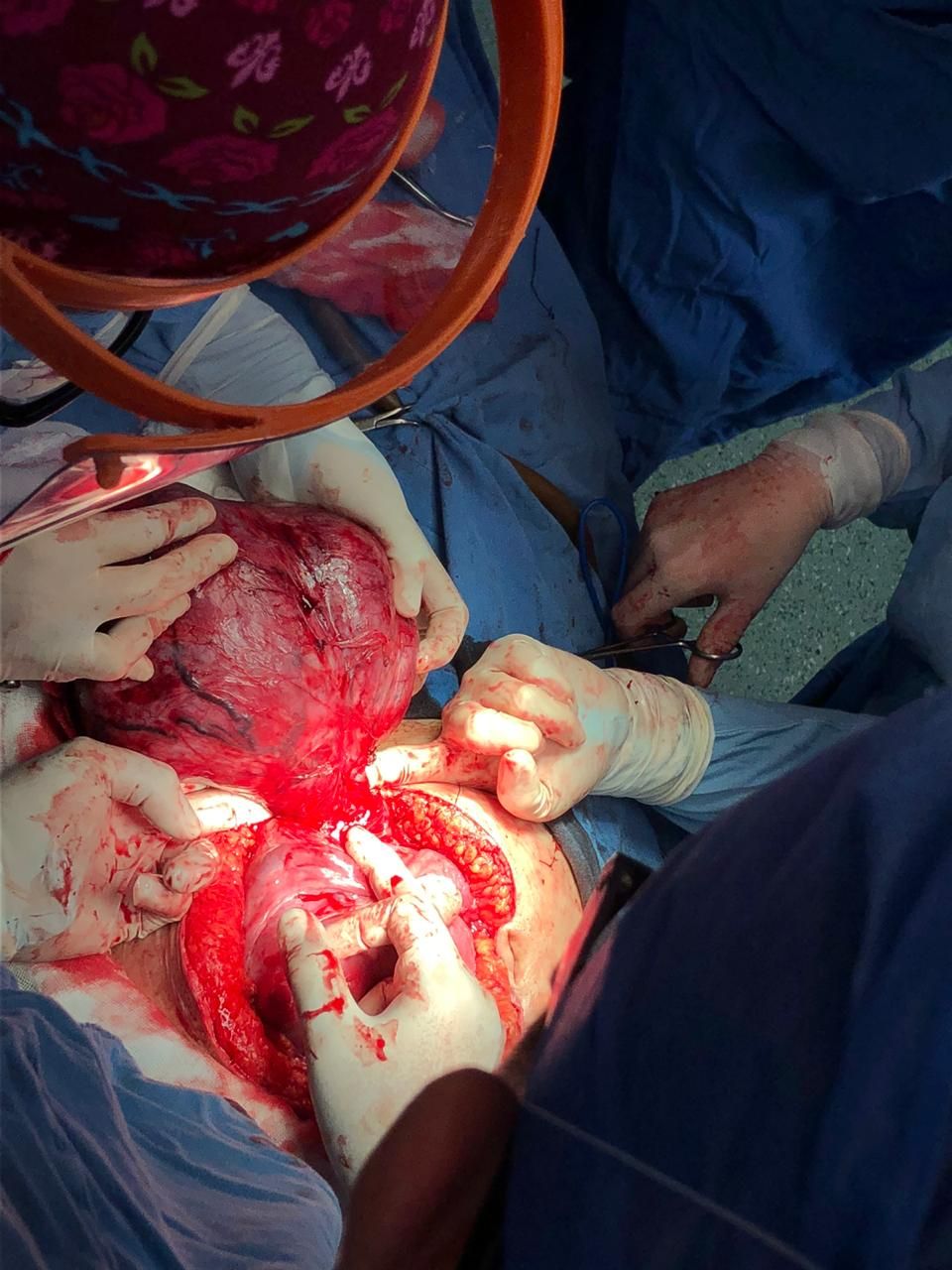 Brenda Anaid Torres Ugalde-20