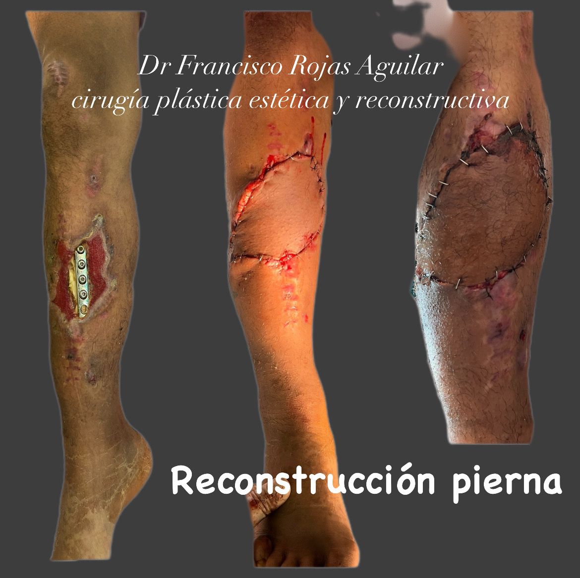 Francisco Rojas Aguilar-8