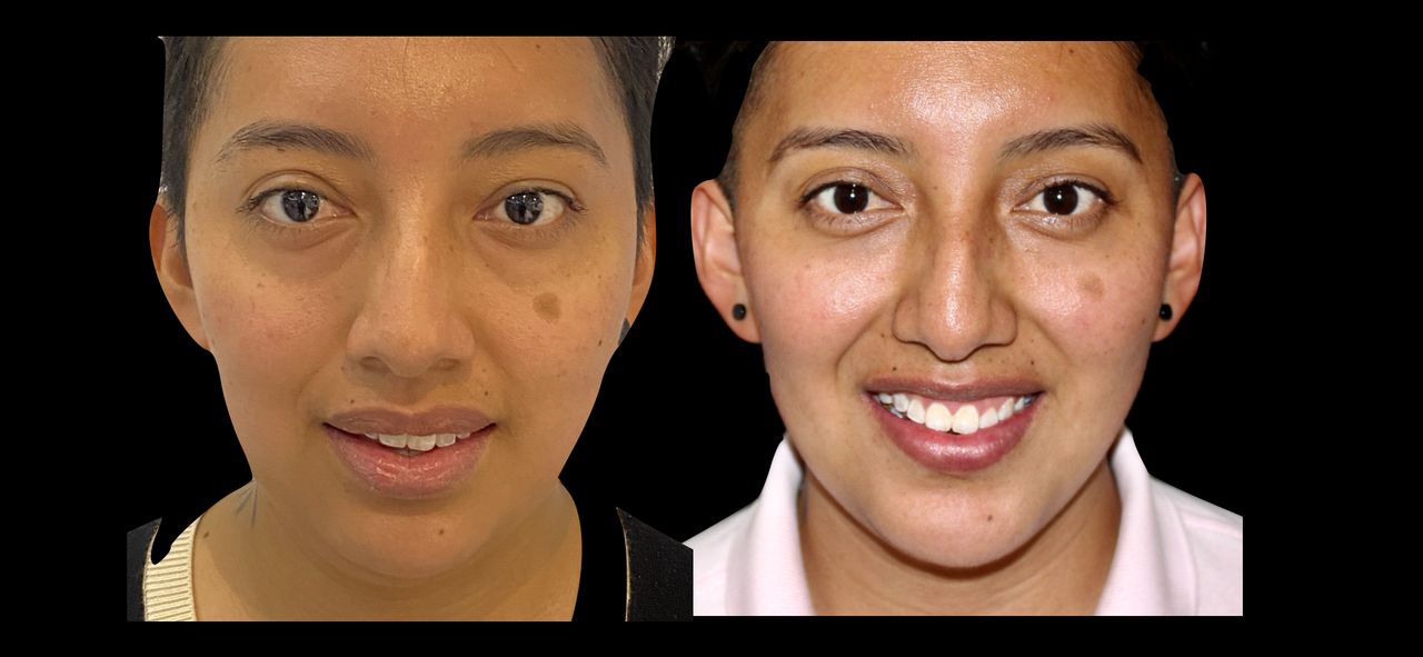 Giovani Ramírez Limón-11