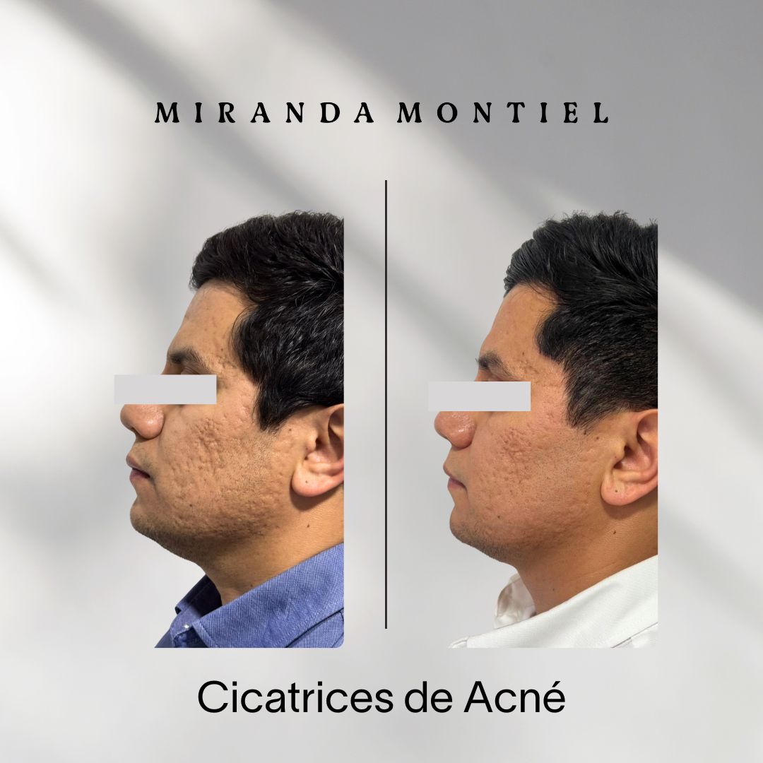 Carlos Guillermo Miranda Montiel-1