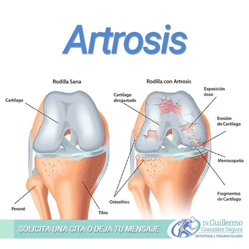 Guillermo González Segura-21