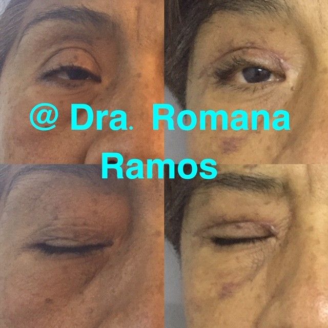 Romana Ramos Cárdenas-23