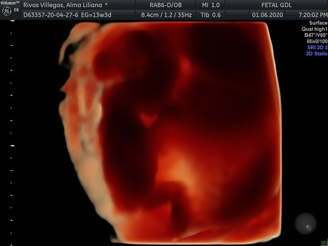 Arturo Herrera Flores-12