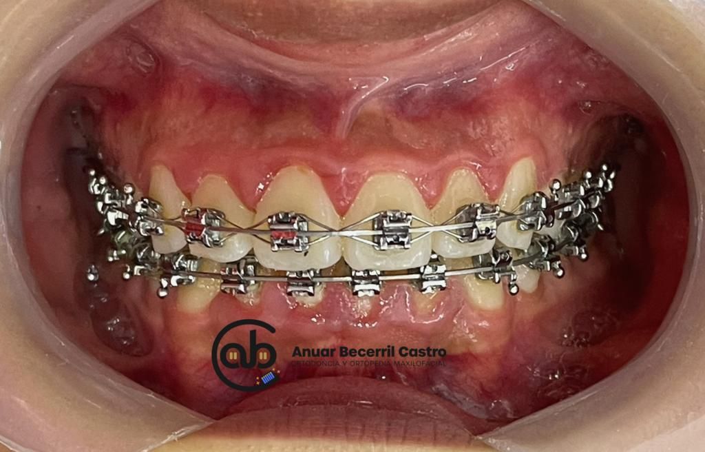 Anuar Becerril Castro-30