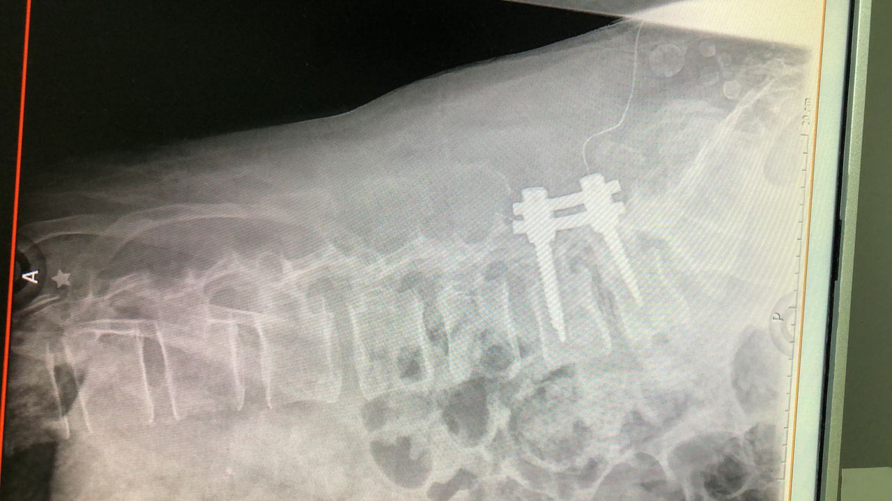 Simón Almanza Mendoza-6