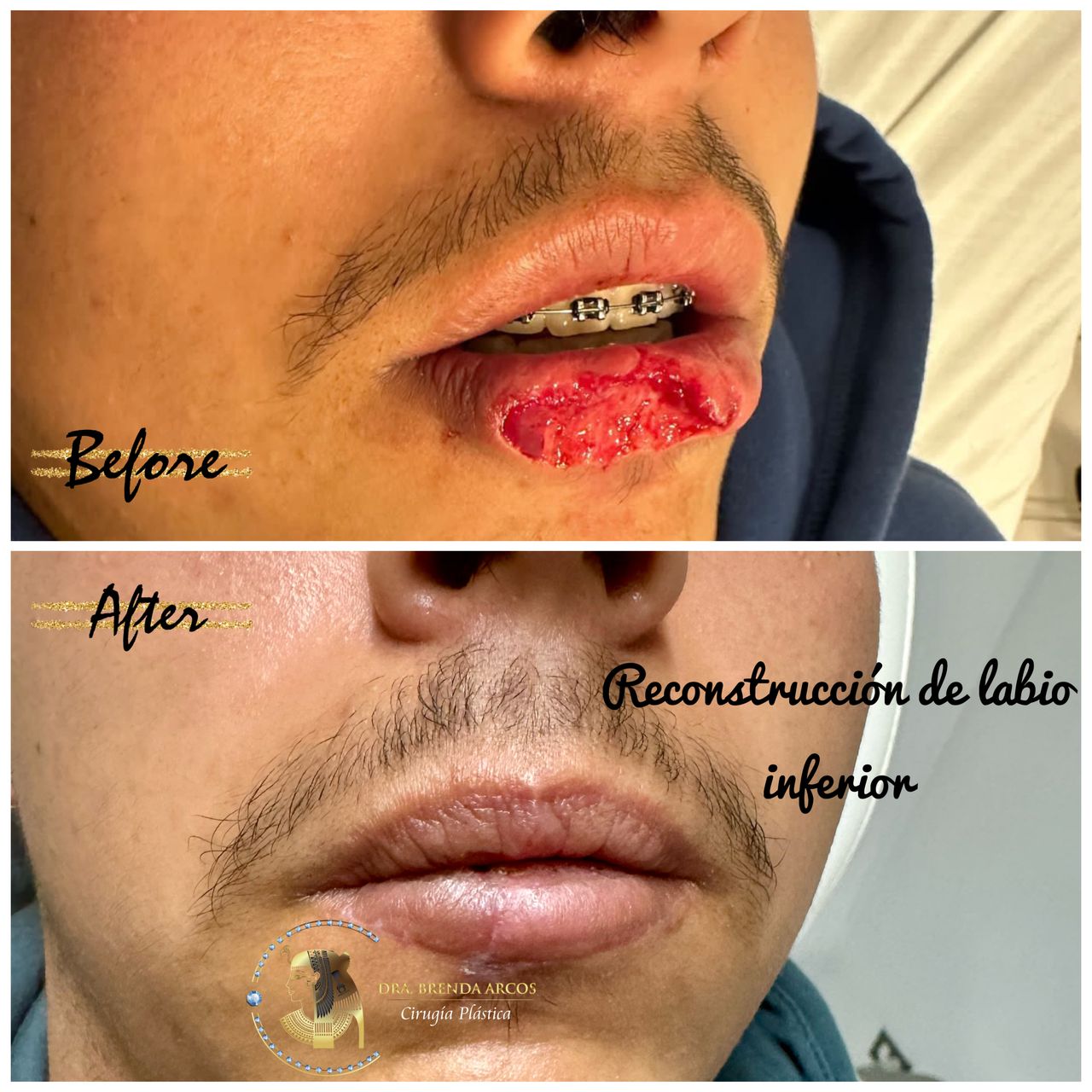 Brenda Arcos Vera-23