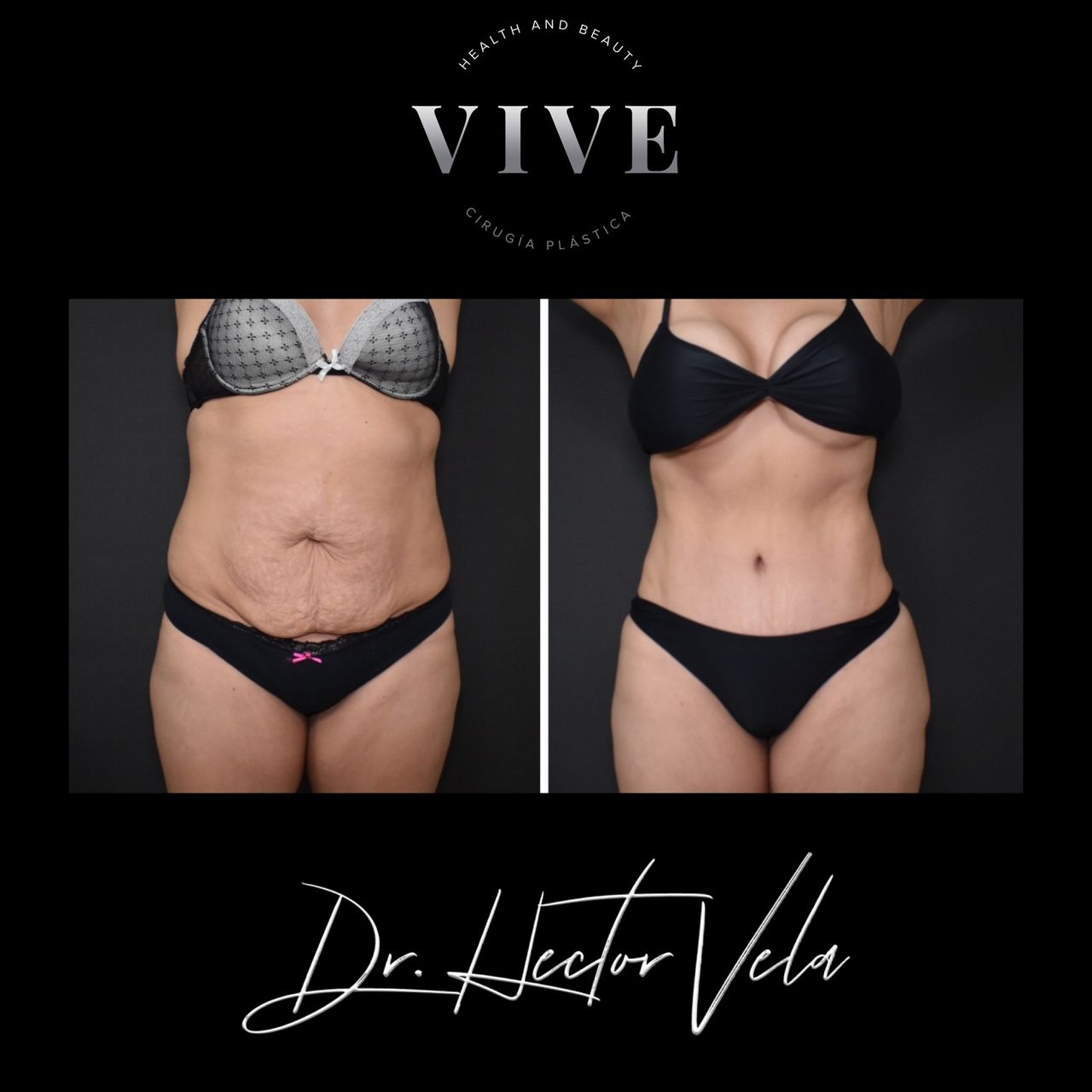 Héctor Eduardo Vela Cardona-147