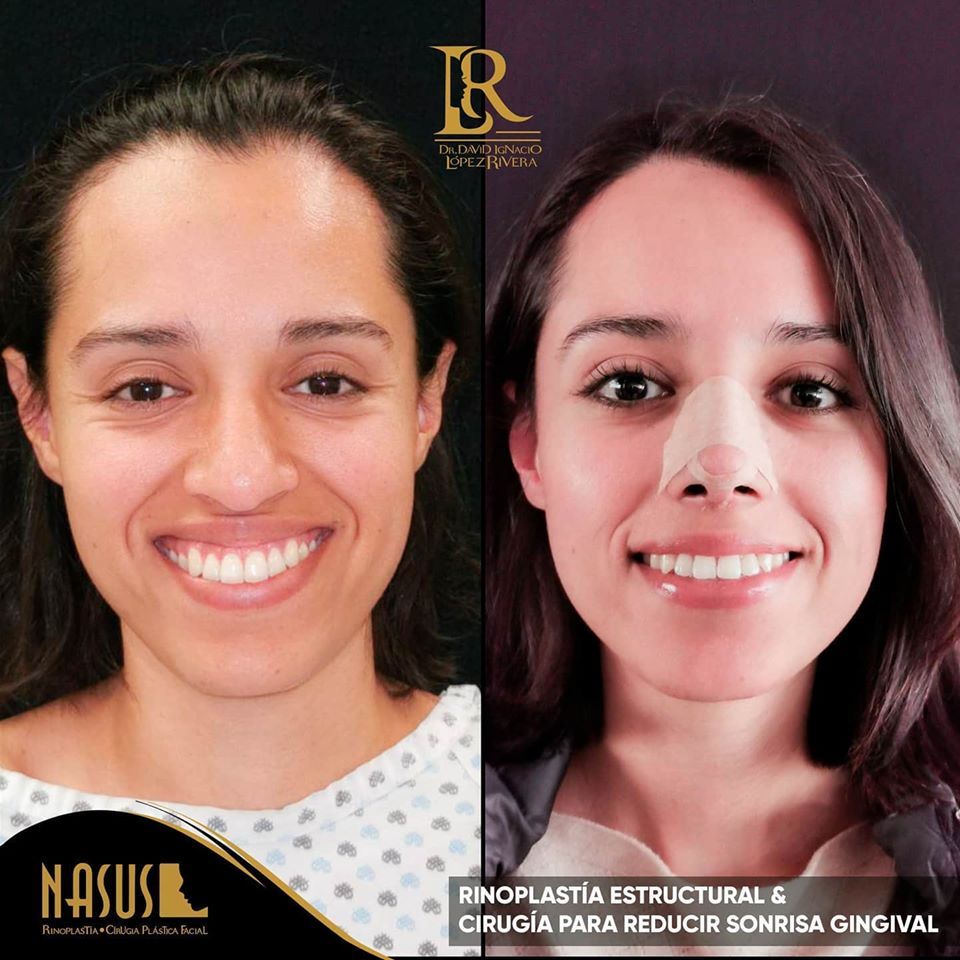 David Ignacio López Rivera-4