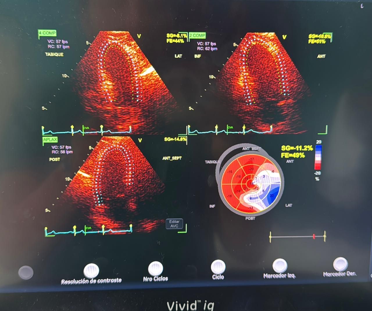 Irene Dominguez Martinez-7