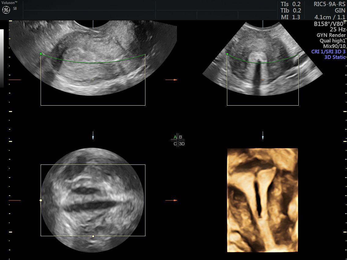 Griselda Reyes Torres-89