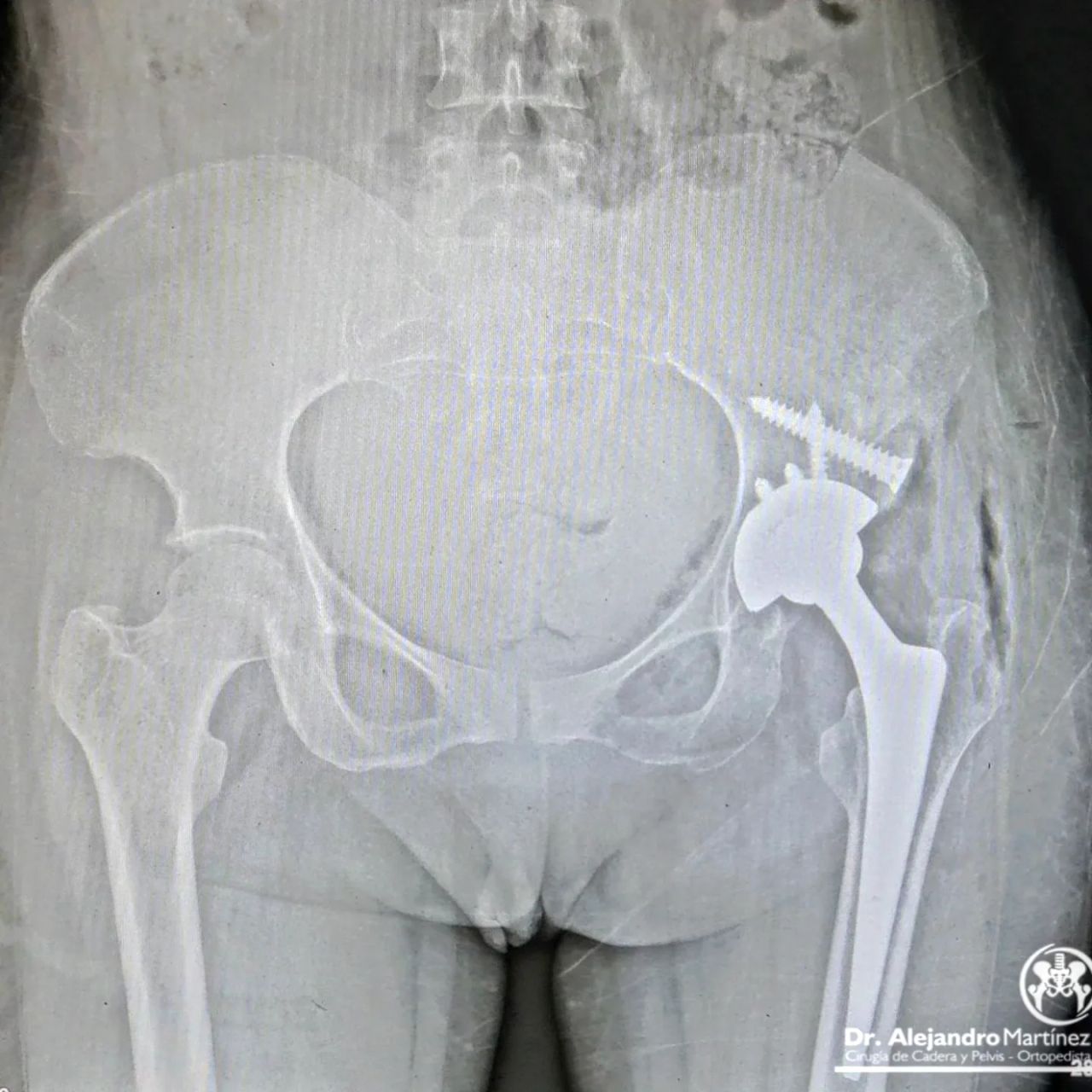 Alejandro Martínez Ramírez-20