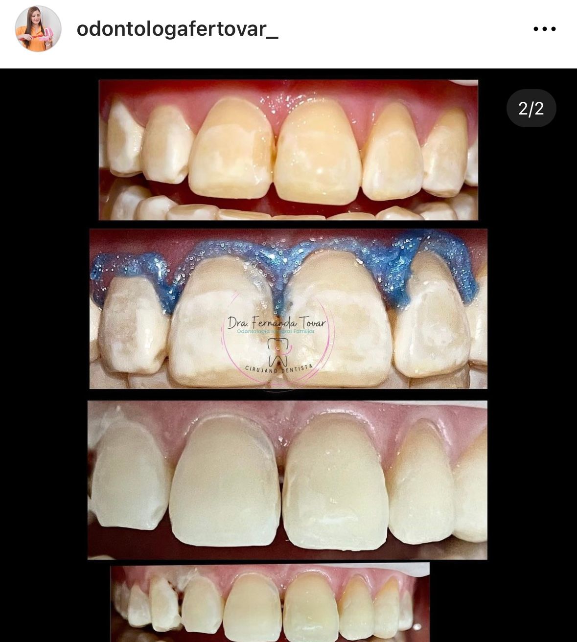 Fernanda Tovar Navarro-19