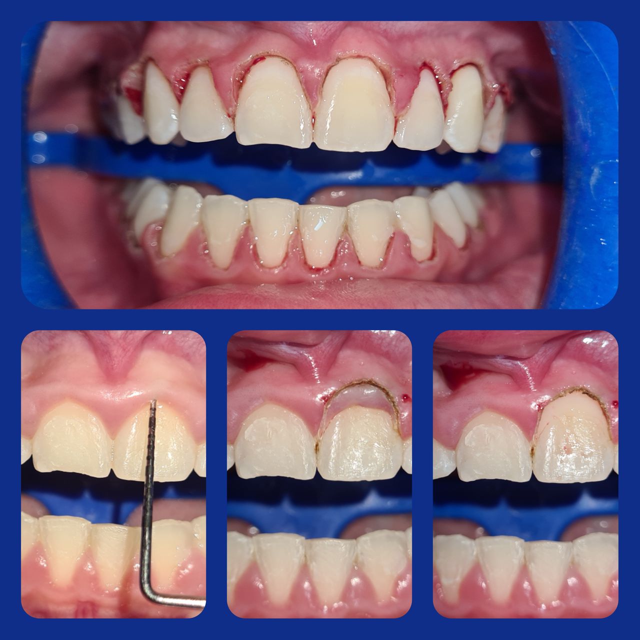 Liz Estela Vazquez Cruz-1