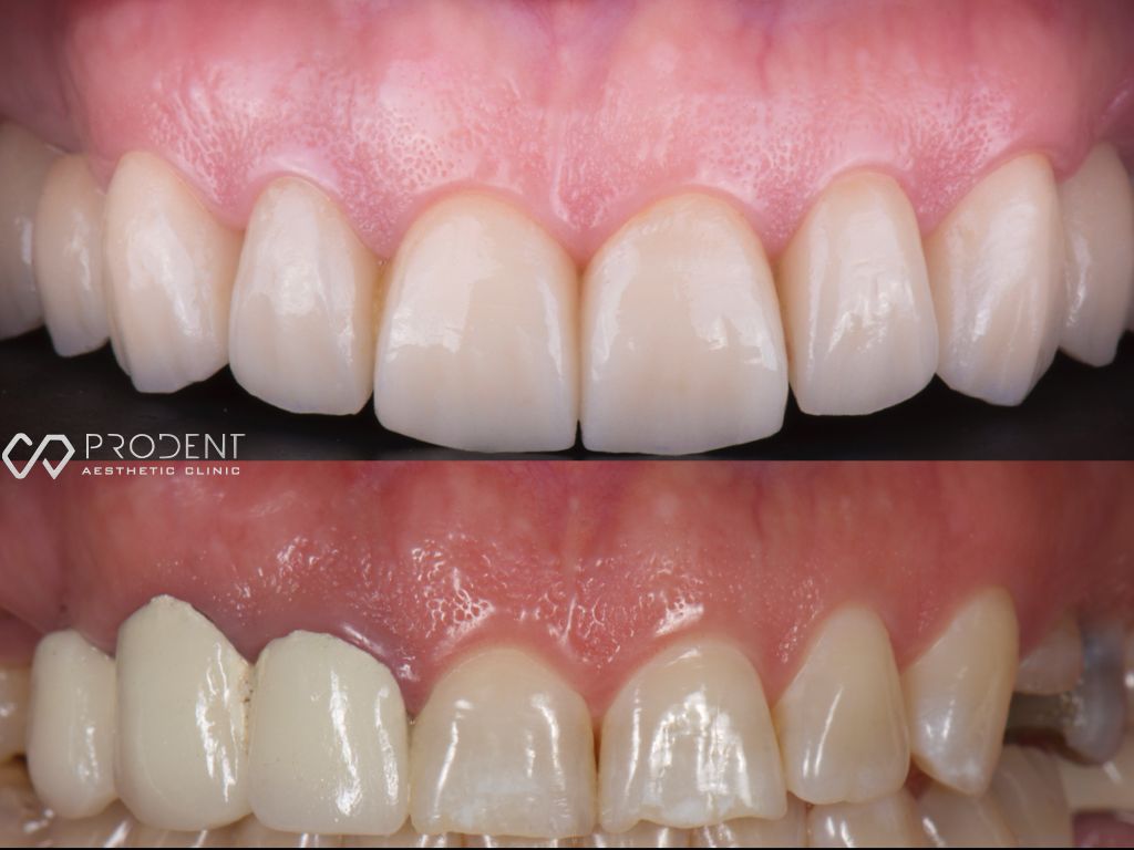 Ulises Pérez Murillo-53