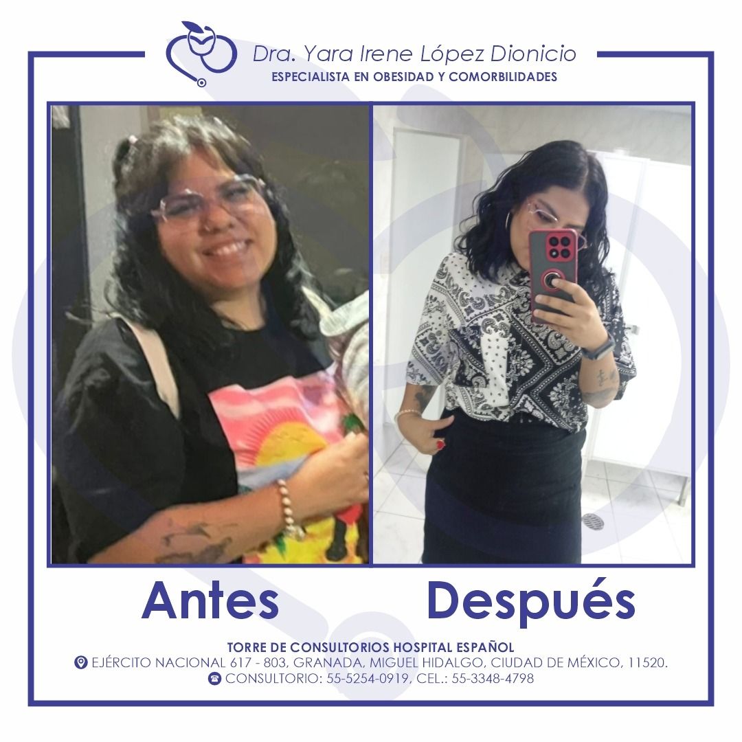 Yara Irene López Dionicio-5