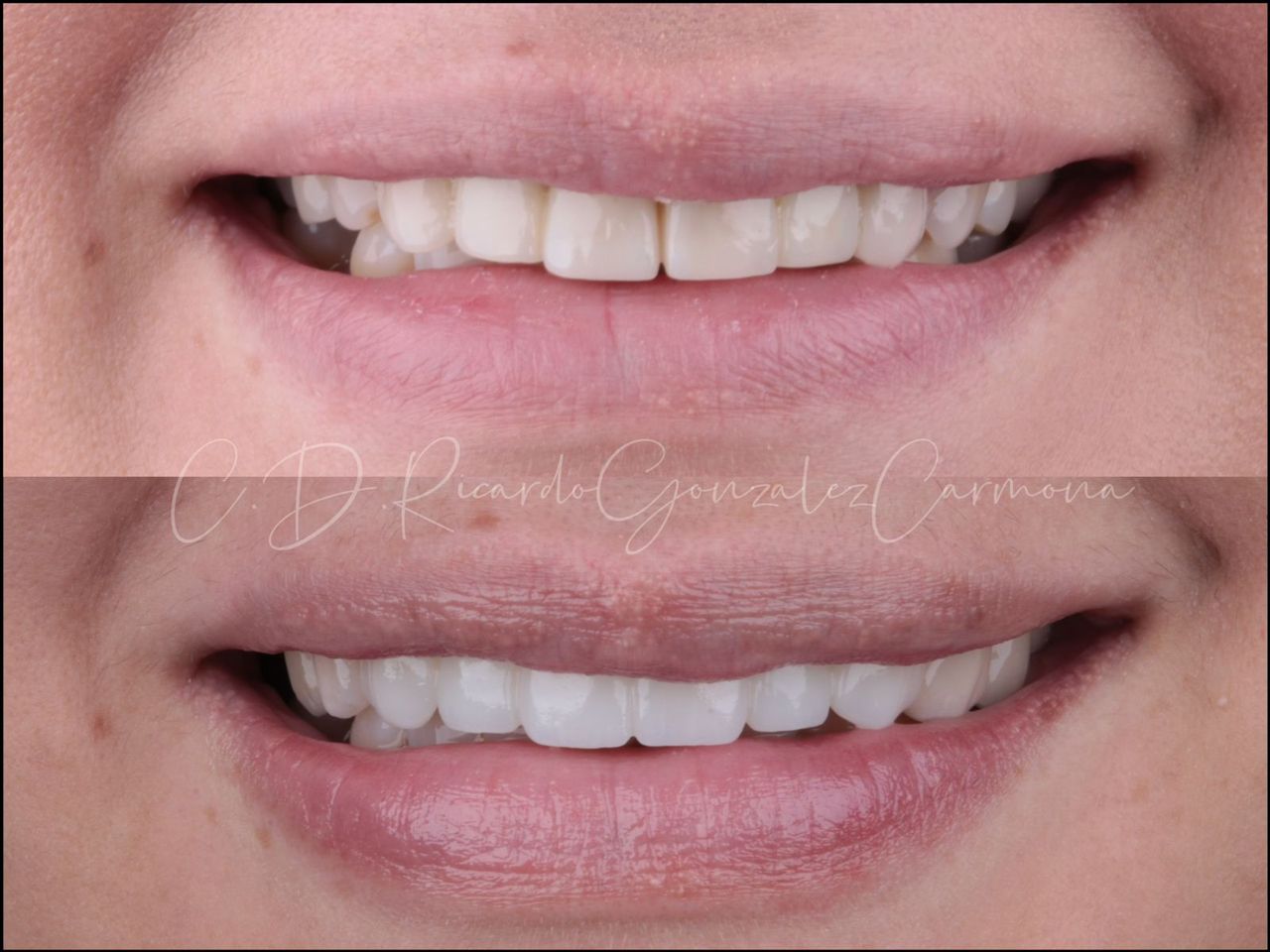 Ricardo González Carmona-7