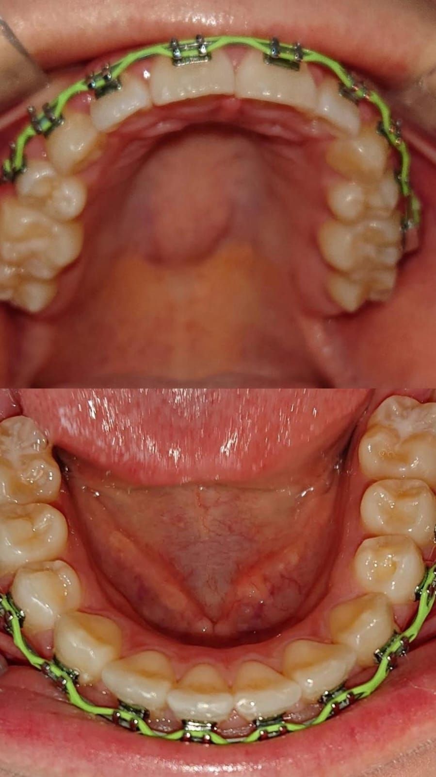 Reyes Silverio Lozano Reza-0