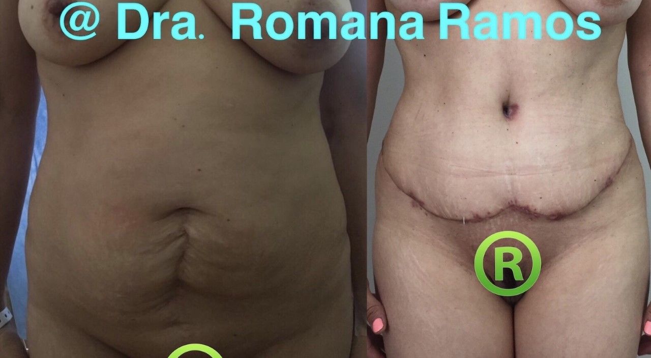 Romana Ramos Cárdenas-14