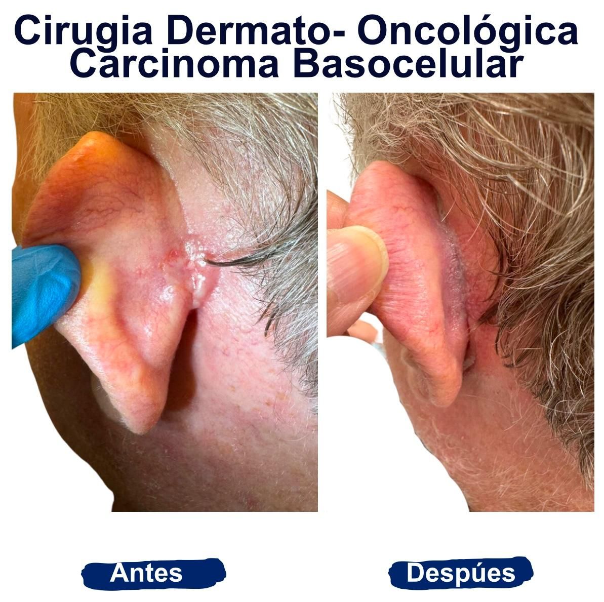 Itzel Anayn Flores Reyes-15