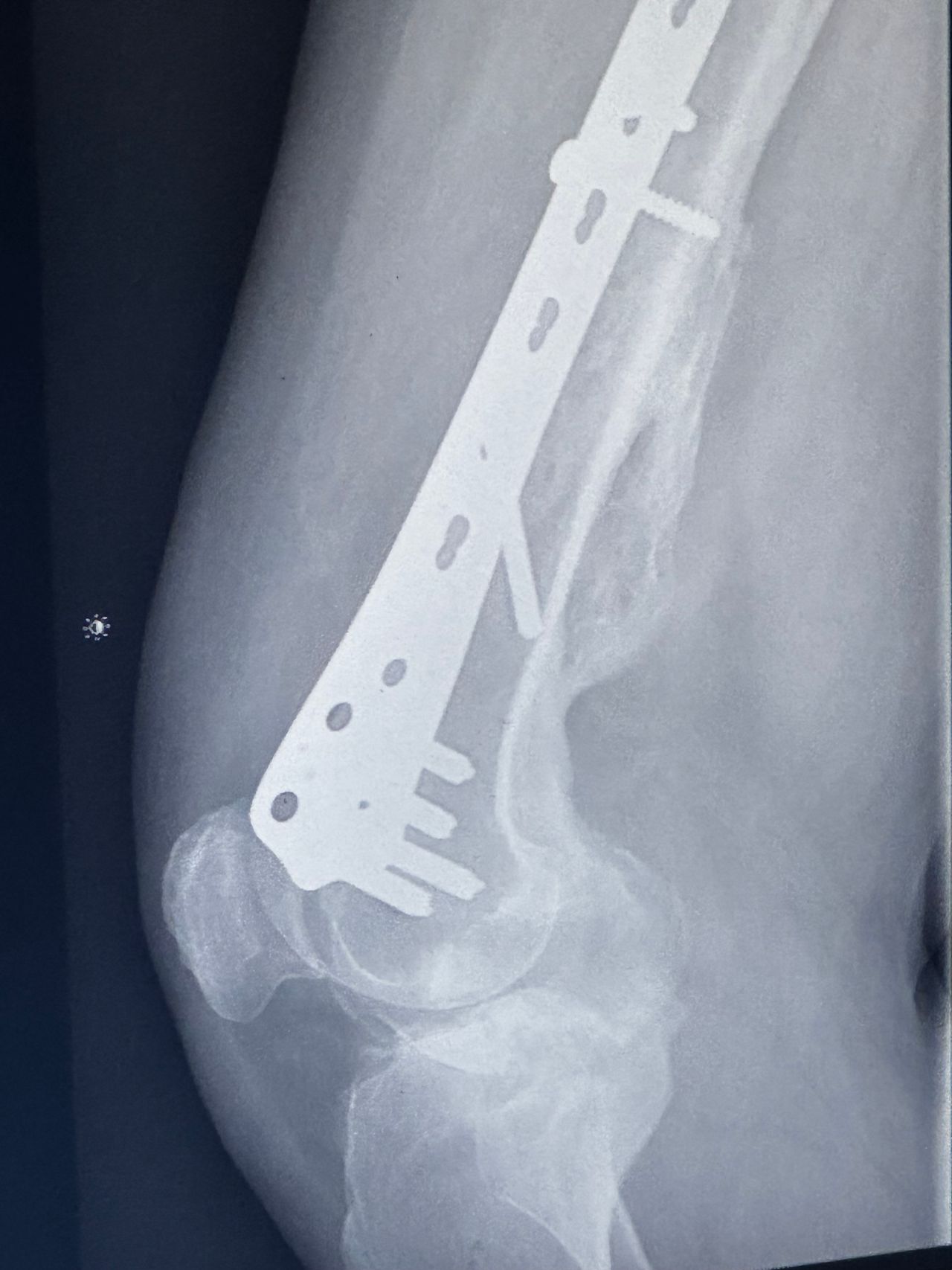 Benjamín Contreras Muñoz-12