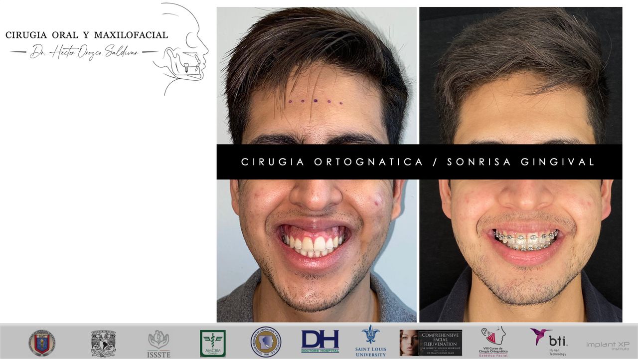 Héctor Adolfo Orozco Saldívar-23