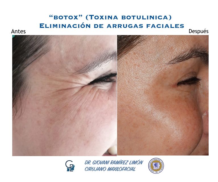 Giovani Ramírez Limón-46