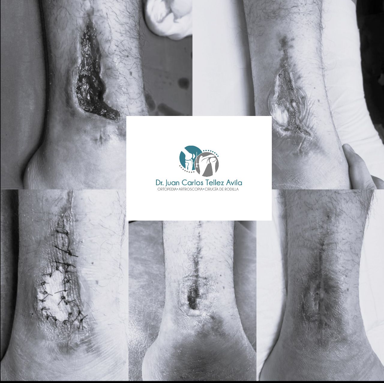 Juan Carlos Tellez Avila-2