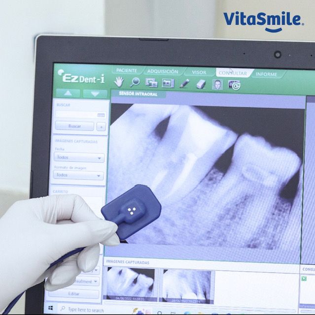 Genesis Johanna Cazares Valles-2