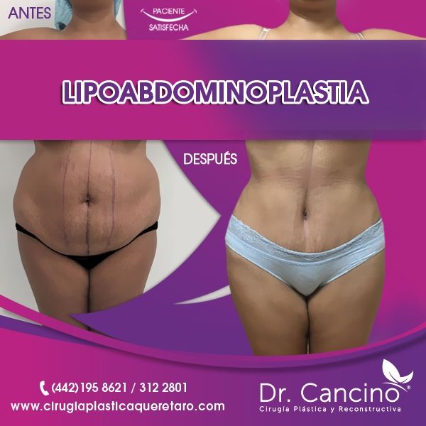 Luis M. R. Cancino-56