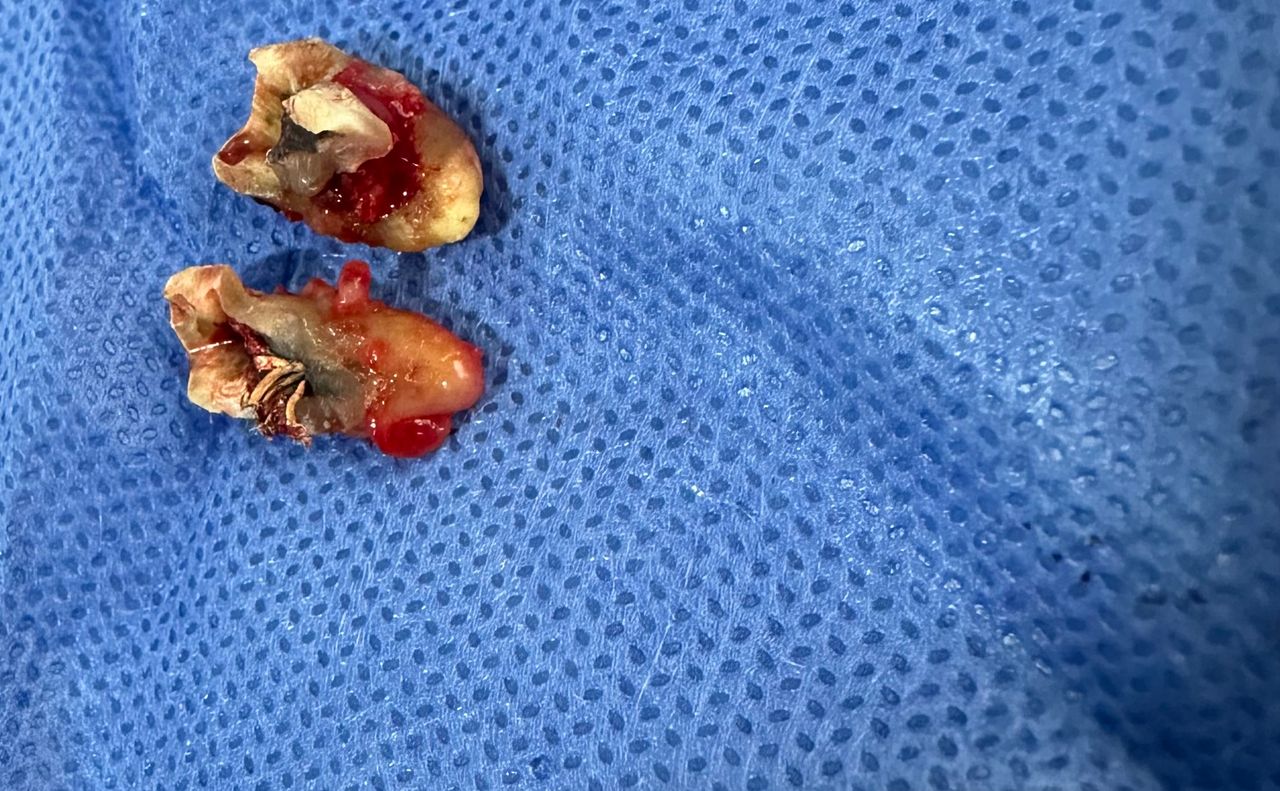 Omar Alejandro Ortiz Rodriguez-14