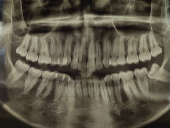 Jonathan Manuel Morán Castell-24