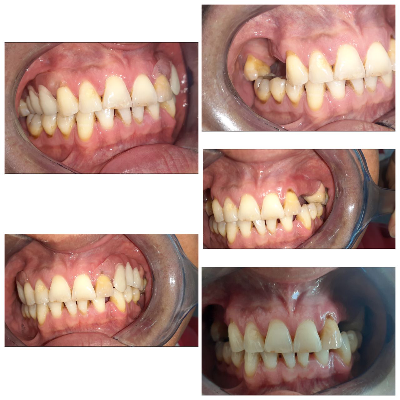 Laura Elizabeth Flores Alcaraz-6