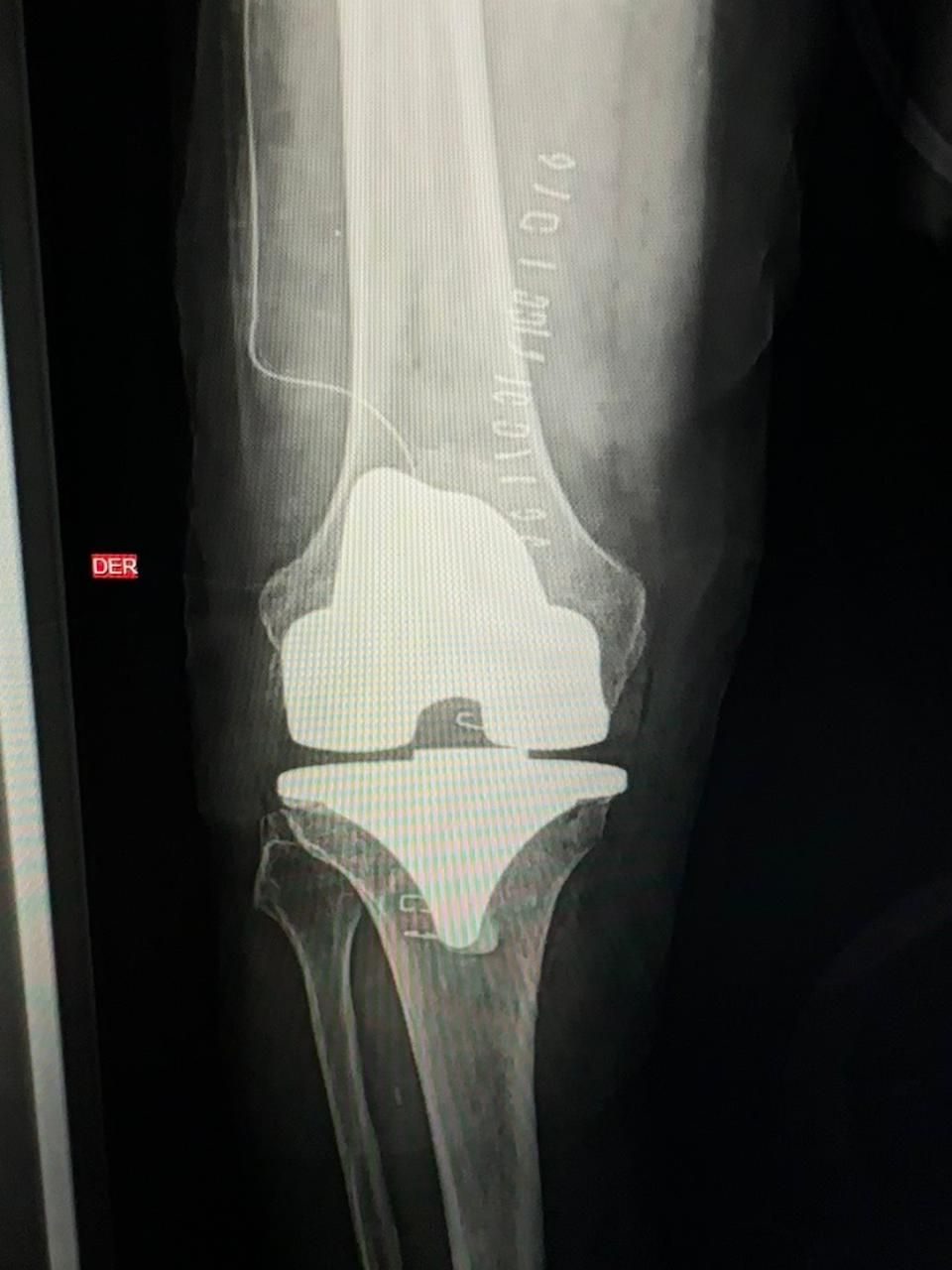 Josmar Adrián Lopez Eng-10