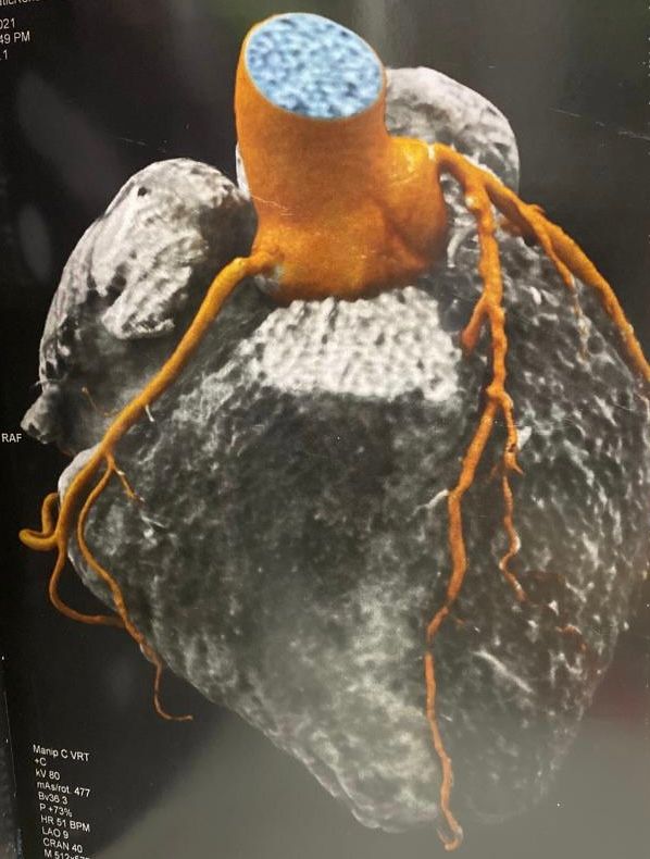 Arturo Moreno Pérez-10