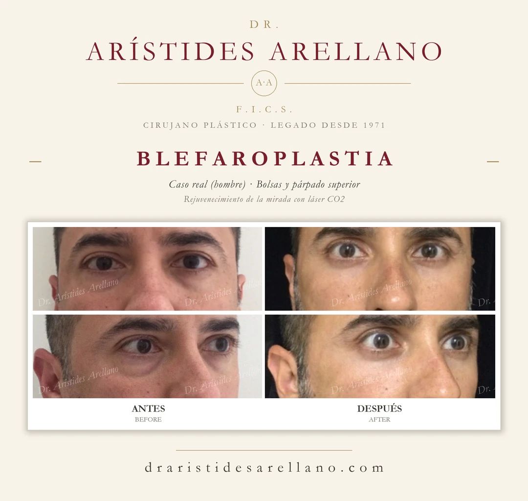 Arístides Arellano Huacuja-21