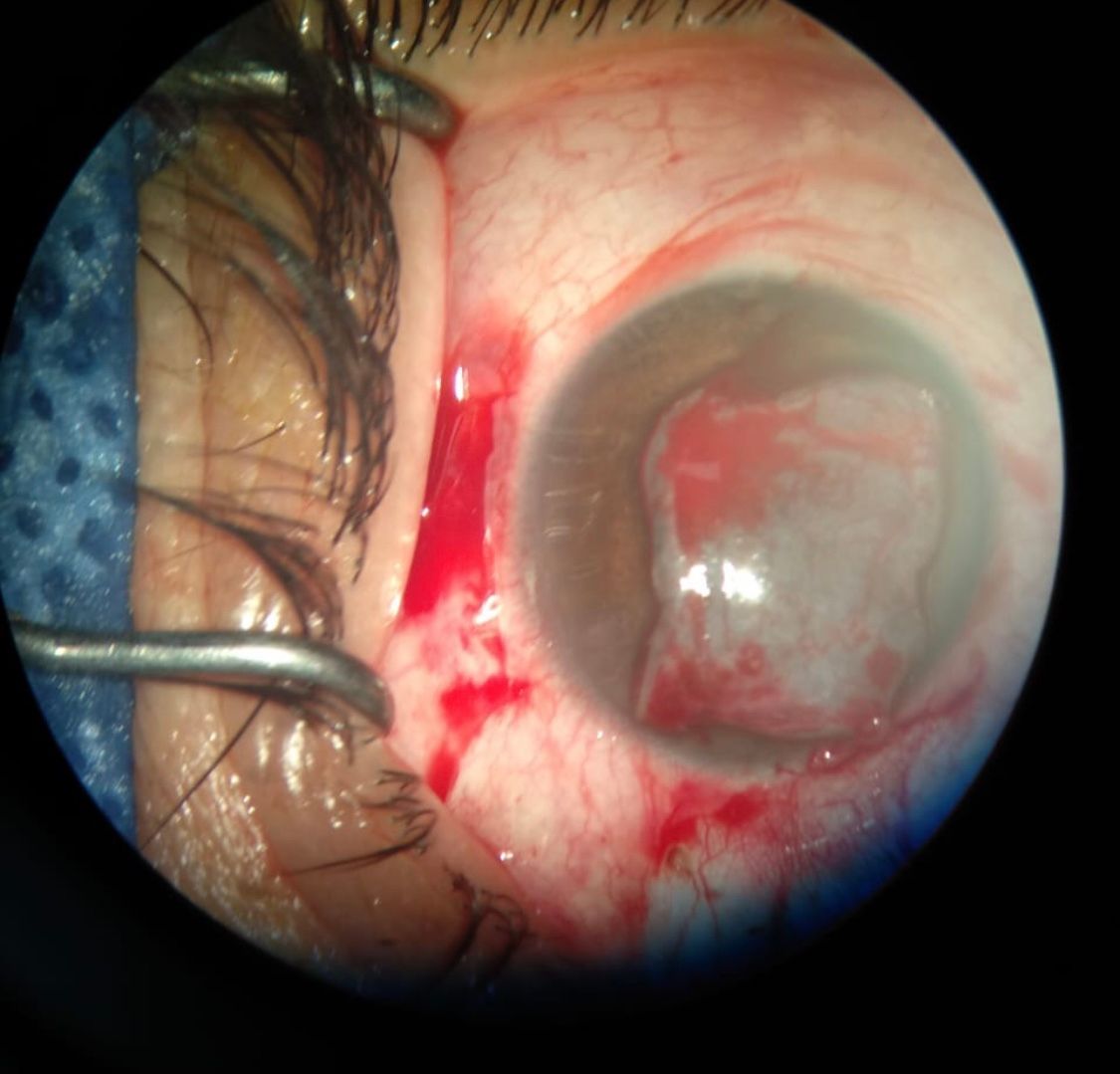 Isela Partida Pulido-13