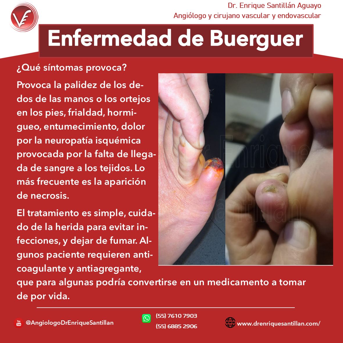 Enrique Santillán Aguayo-6